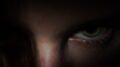 Trachoma