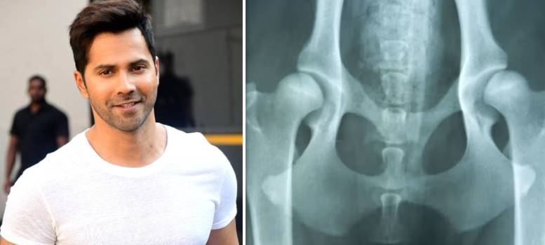 Varun Dhawan-এর মেয়ের ডিডিএইচ সমস্যা ছিল, কী এই রোগ