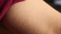 Goosebumps