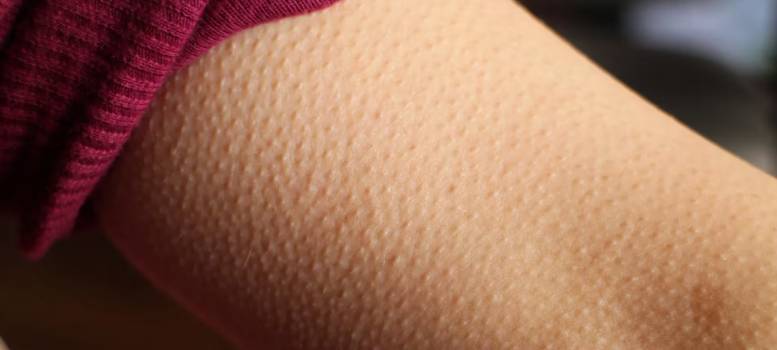 Goosebumps কখন হয় আর কেন হয়, জেনে নিন